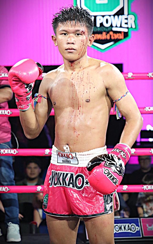 โล่ห์เงิน กรวยในเมืองยิมส์